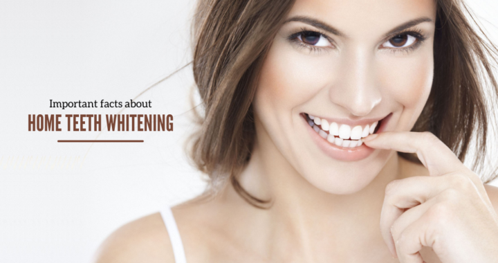 Important Facts About Home Teeth Whitening